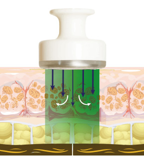 Body-verde-actua